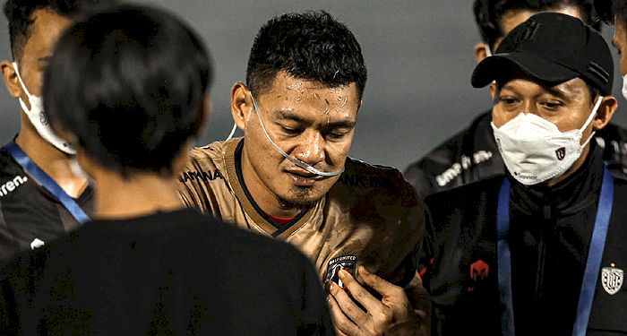 Setelah Laga Kontra Persib, Kiper Bali United Dilarikan ke Rumah Sakit